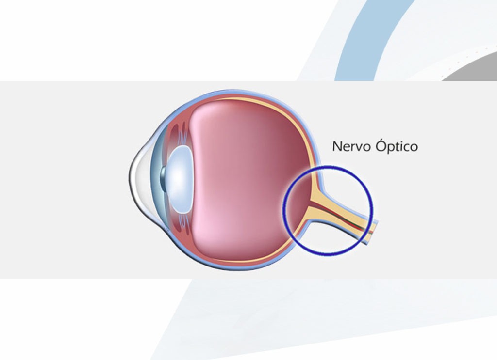 Nervo Óptico-Oftalmologista-Campinas-SP