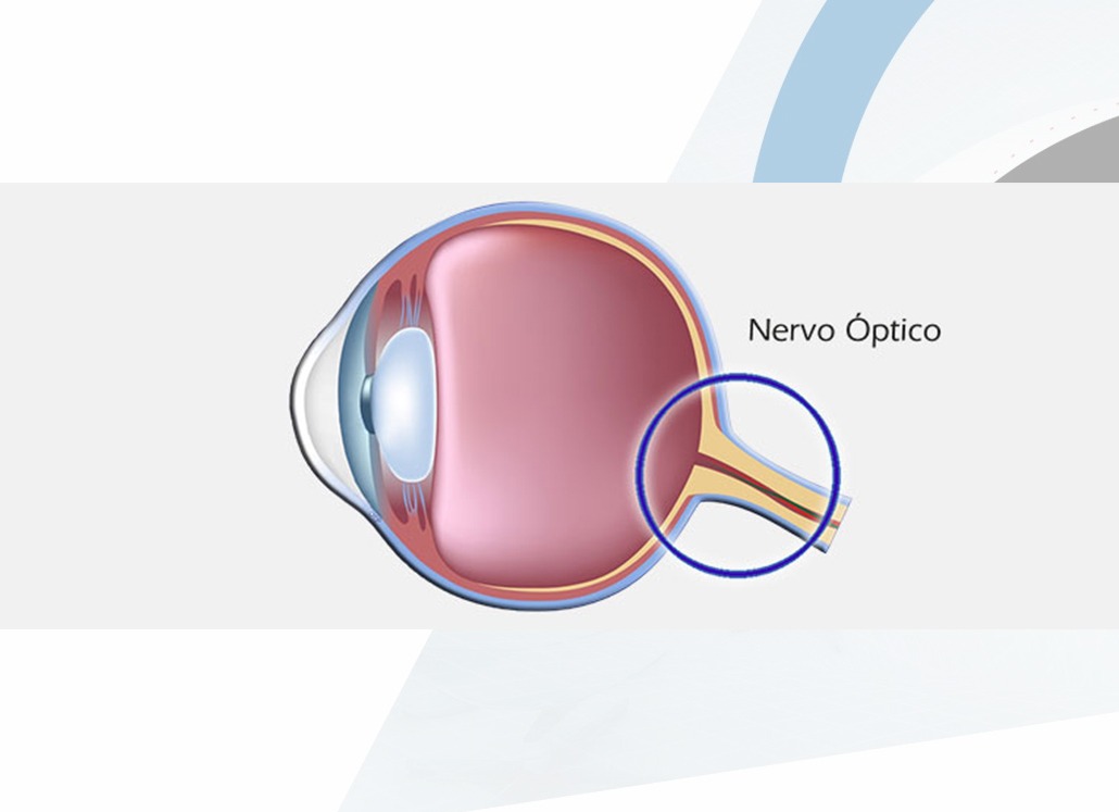 Nervo Óptico-Oftalmologista-Campinas-SP