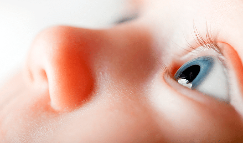 À retinopatia da prematuridade tem cura?