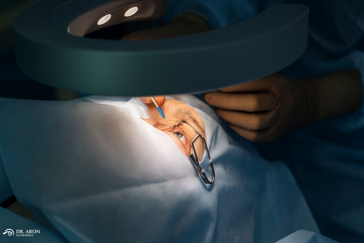 Cirurgia Refrativa