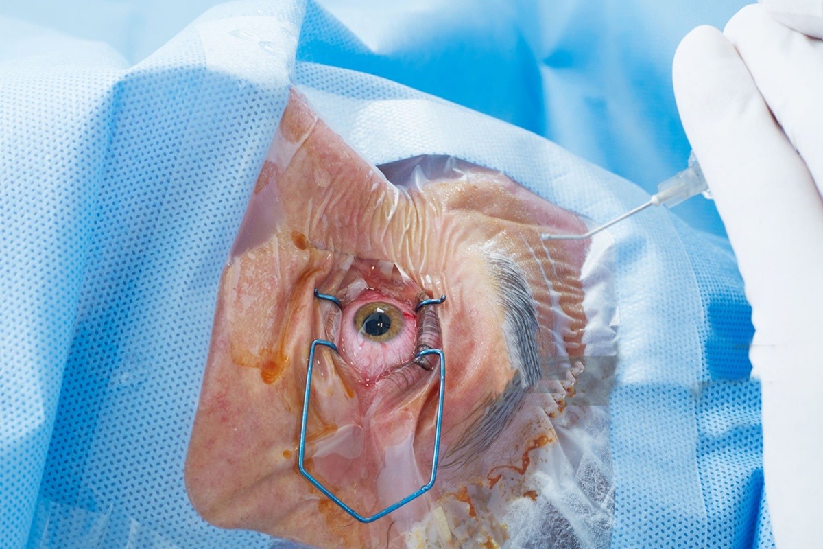 cirurgia retroativa
